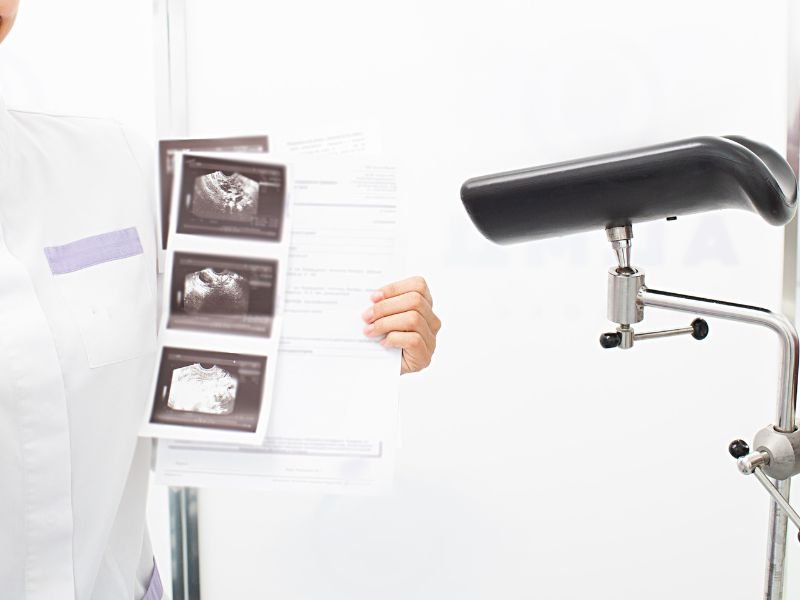 Colposcopia O Que Esperar Deste Exame e Sua Importancia na Prevencao do Cancer