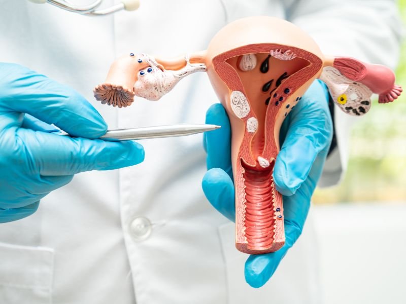 Deteccao e Tratamento do Cancer Ginecologico em Curitiba