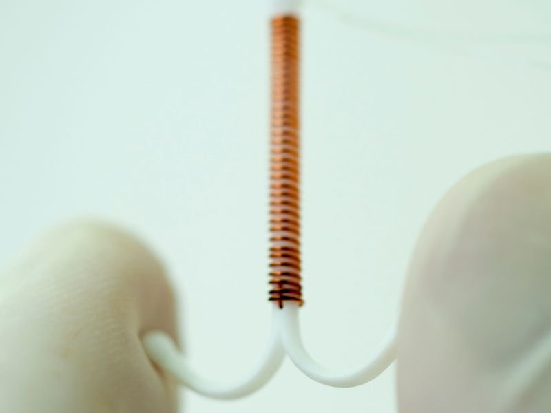 DIU Opcao Contraceptiva de Longa Duracao e Baixa Manutencao