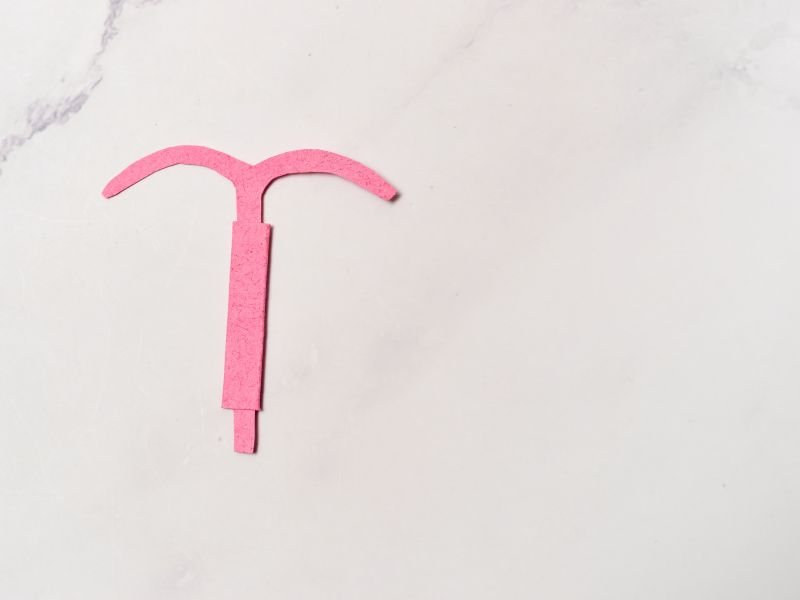 DIU hormonal Curitiba