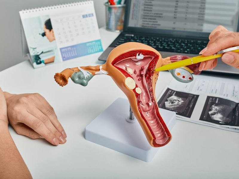 Especialista em cancer ginecologico Curitiba