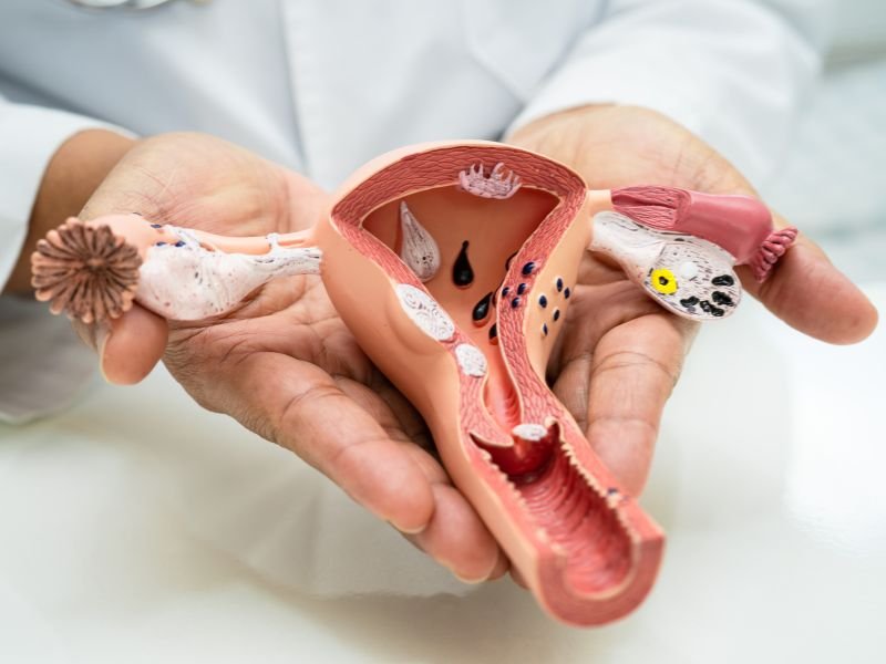 Especialista em endometriose Curitiba