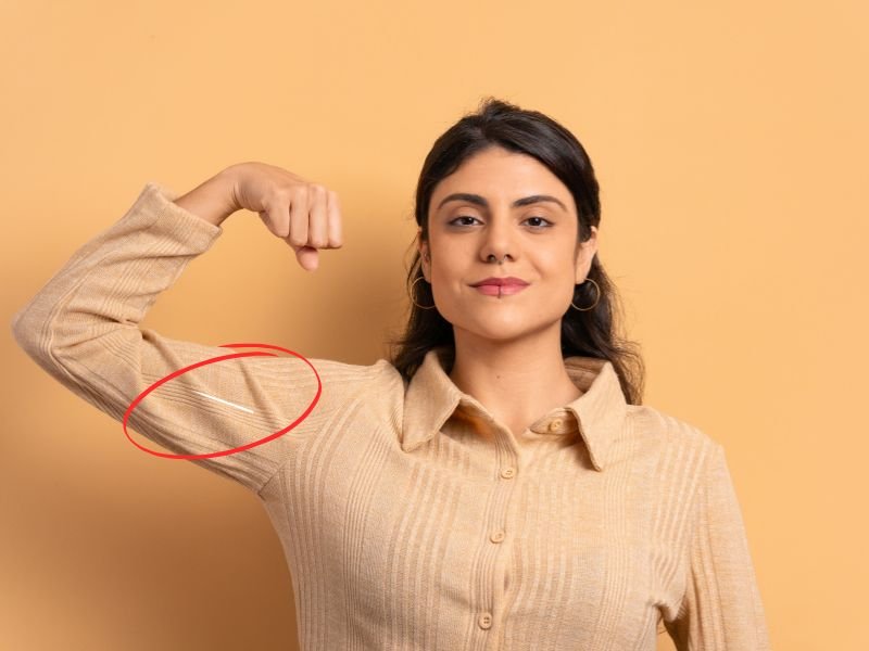 Implante Implanon Curitiba