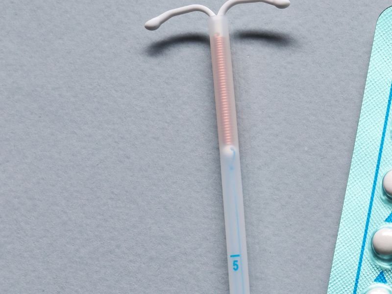 Implante de DIU Curitiba